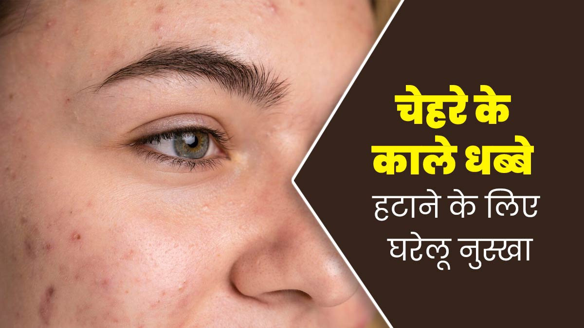 काले दाग-धब्बों से छुटकारा पाने के लिए लगाएं केला, दूध और आलू से बना फेस मास्क, जानें तरीका 