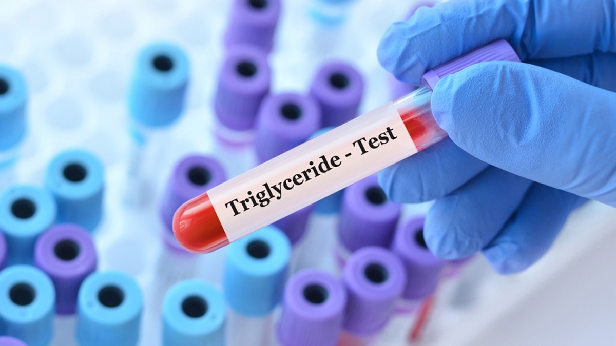 triglycerides