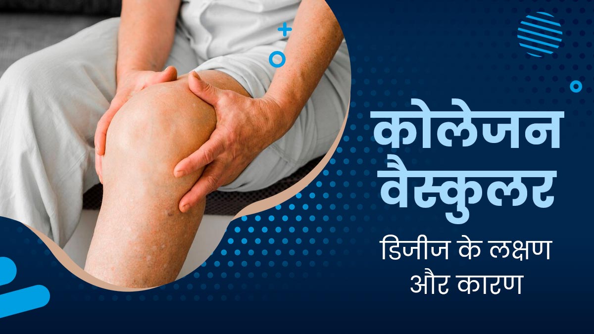 कोलेजन वैस्कुलर डिजीज क्या है? जानें इस ऑटो इम्यून बीमारी के लक्षण और कारण
