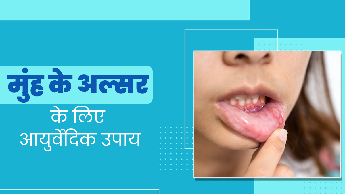 Stomatitis: मुंह में सूजन और छालों की समस्या से राहत पाने के लिए अपनाएं ये 5 आयुर्वेदिक उपाय