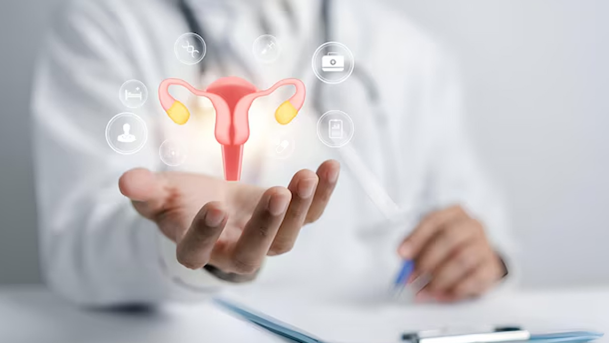 PCOS