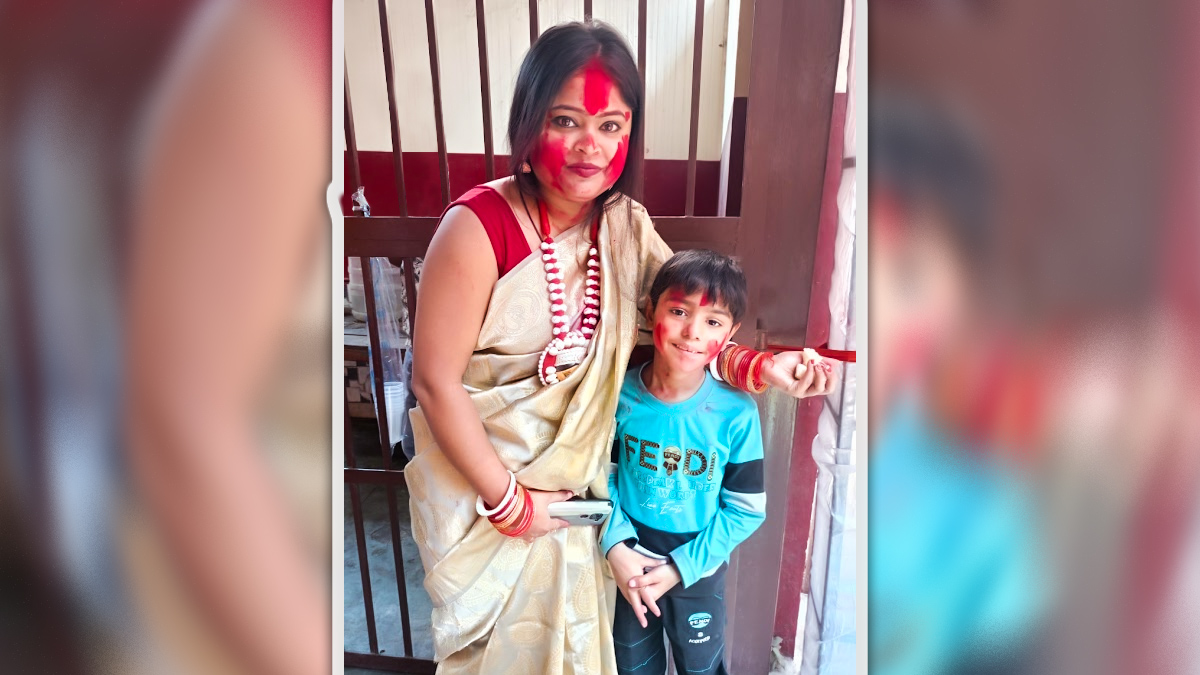 Skin-Burning-Due-To-Sindoor-Khela