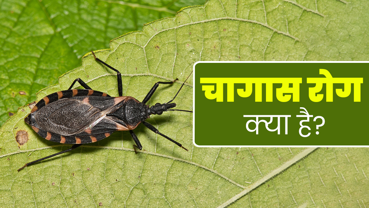 दुन‍ियाभर में फैल रहा है साइलेंट क‍िलर कहे जाने वाला चागास रोग, जानें इसके लक्षण, कारण और इलाज 