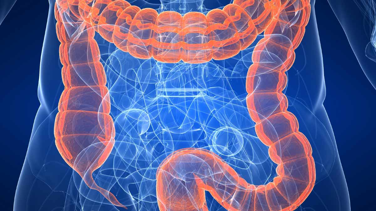 Sleep, Stress, and Gut Health: Key Factors in Colorectal Cancer Progression, Study Reveals
