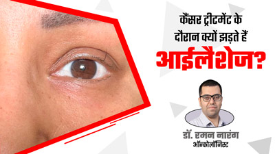 झड़ गईं हिना खान की सारी पलकें, डॉक्टर से जानें कैंसर के इलाज के दौरान ऐसा क्यों होता है?