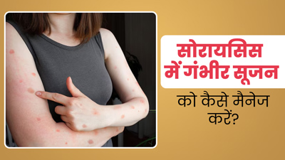 सोरायसिस के कारण हो गई है सूजन, तो राहत पाने के लिए अपनाएं ये 5 उपाय