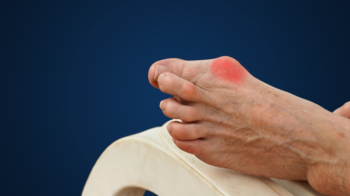 Experiencing Joint Pain In Your Big Toe: Here's What May Be Causing It