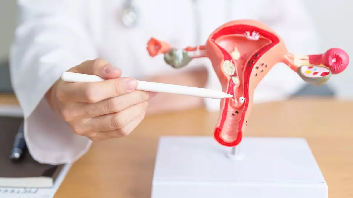 Breakthrough Cervical Cancer Treatment Cuts Death Risk By 40%, Lancet Study Reveals 
