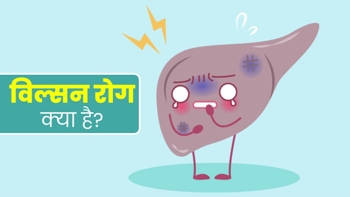 Wilson Disease: शरीर में कॉपर की ज्यादा मात्रा बन सकती है इस दुर्लभ बीमारी का कारण, जानें इसके लक्षण और इलाज