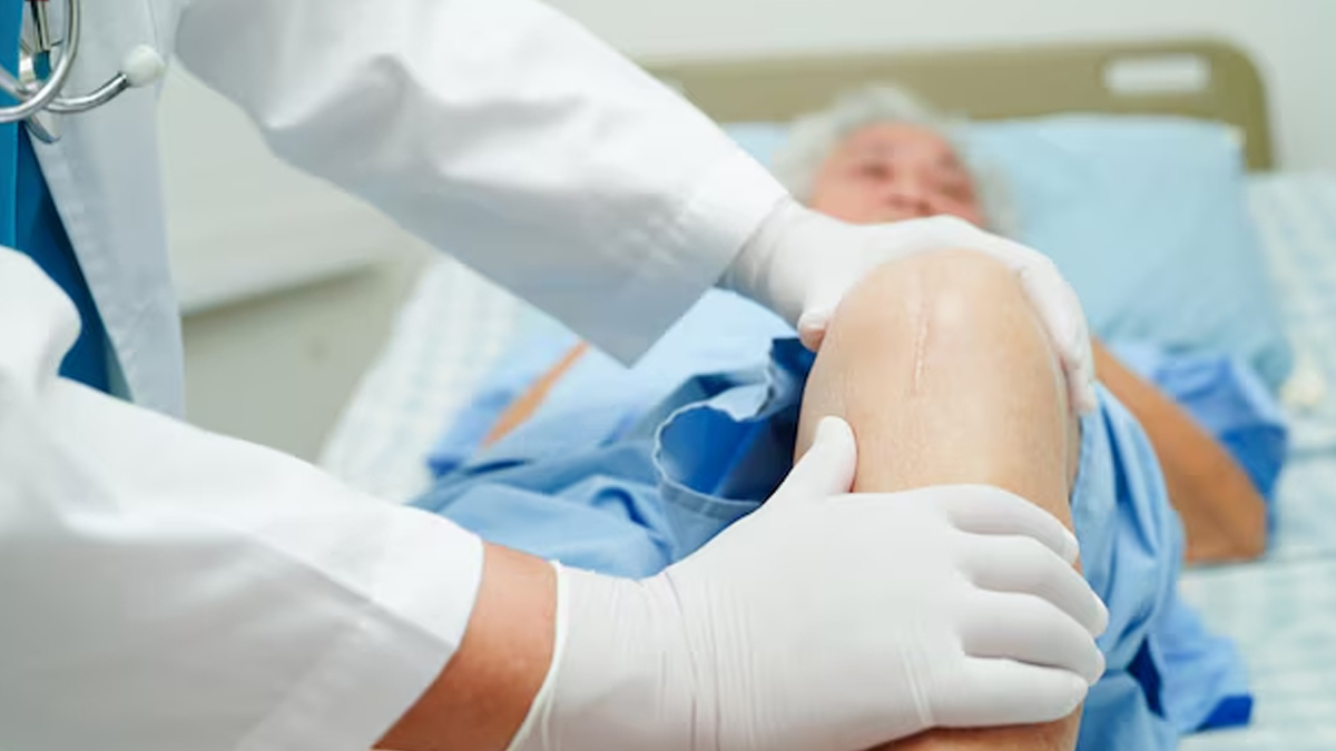 knee-replacement-surgery