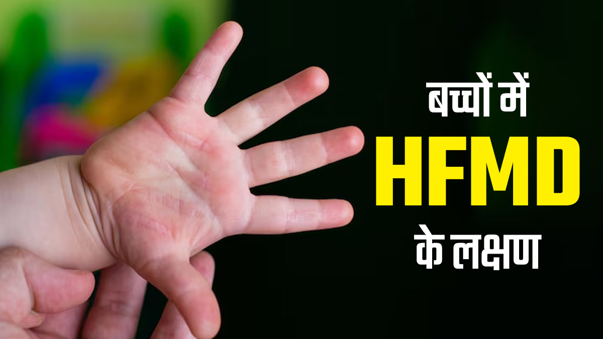 छोटे बच्चों में बेहद आम है हाथ, पैर और मुंह की बीमारी (HFMD), जानें इसके लक्षण और बचाव के उपाय