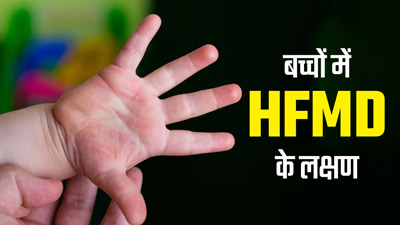 छोटे बच्चों में बेहद आम है हाथ, पैर और मुंह की बीमारी (HFMD), जानें इसके लक्षण और बचाव के उपाय