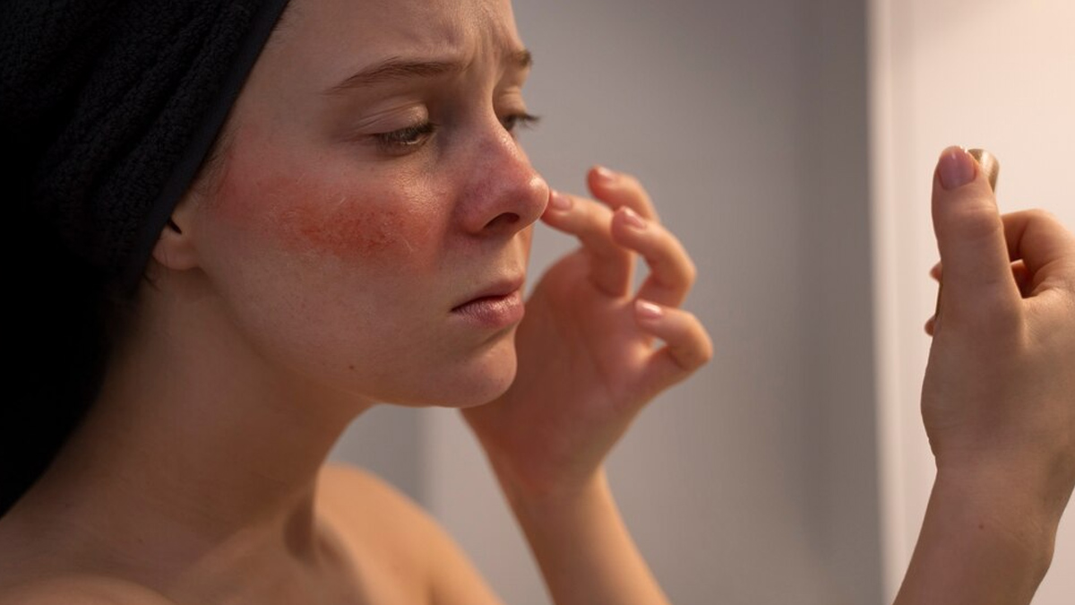 Red Spots On Skin Here Are Its Common Causes And How To Get Rid Of Red Spots On Skin Here Are Its Common Causes And How To Get Rid Of
