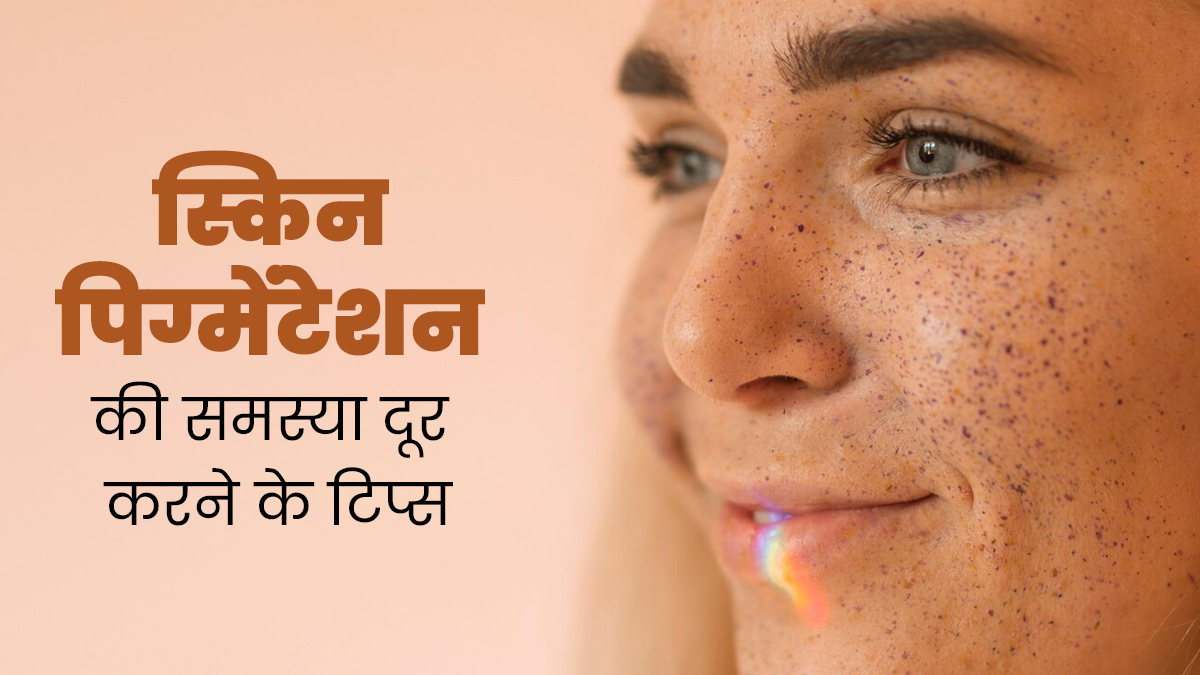 चेहरे के पिग्मेंटेशन से छुटकारा पाने के लिए अपनाएं ये 5 टिप्स, मिलेगी क्लियर और ग्लोइंग स्किन