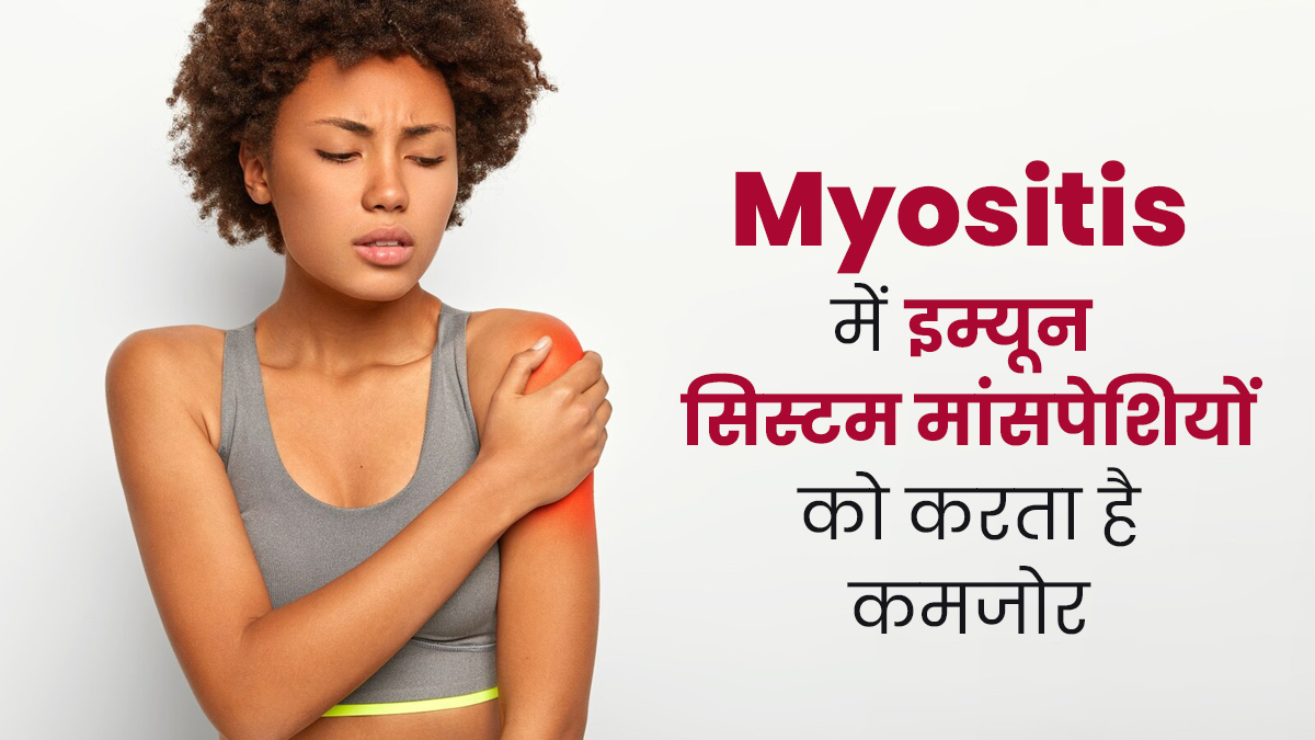 Myositis : इस रोग में इम्यून सिस्टम मांसपेशियों को करता है कमजोर, जानें इसके कारण 