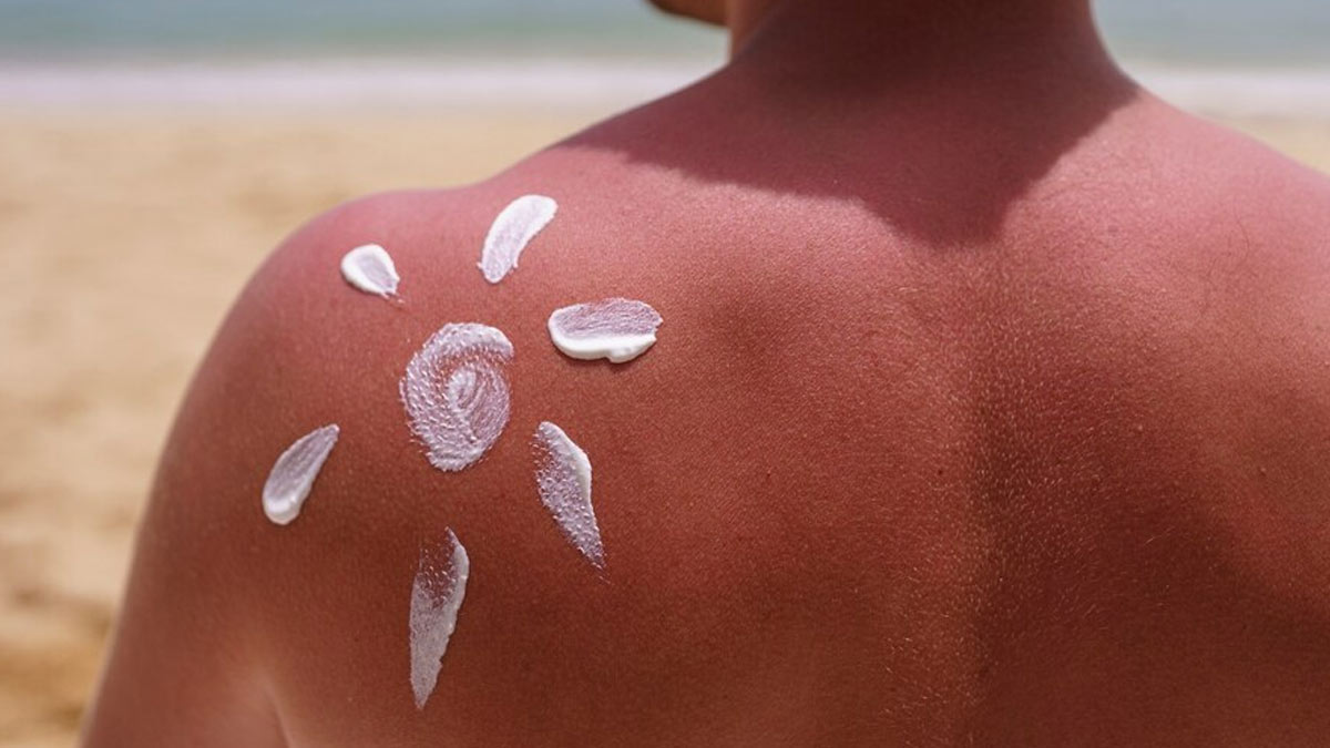Skin Cancer: Factors That Affect Ultraviolet (UV) Risk