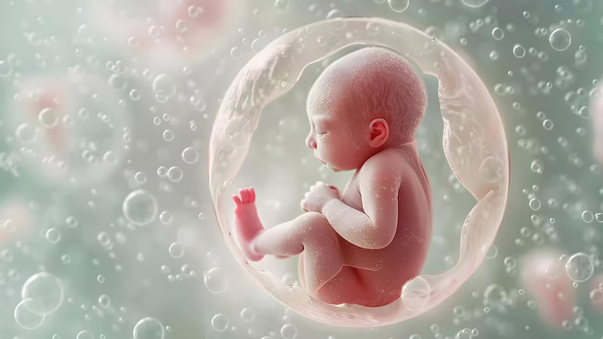 IVF