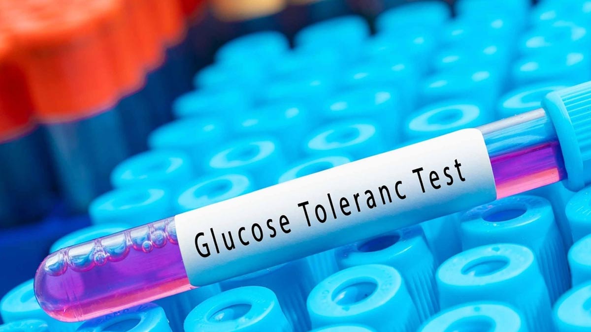 What Is The Role Of Glucose Tolerance Test And When Can It Be Conducted?