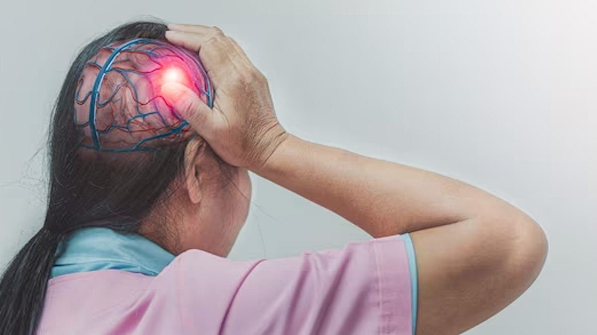 Expert Debunks Common Misconceptions About Strokes That Need To Be Addressed