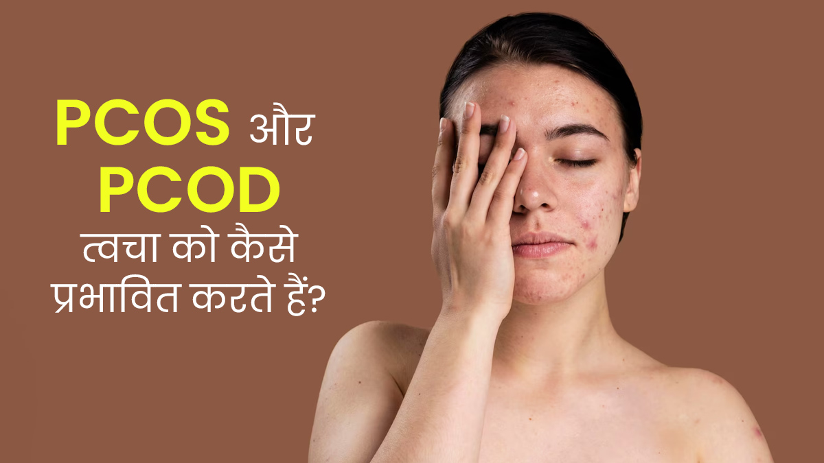PCOS और PCOD में स्किन हेल्थ पर क्या असर पड़ता है? एक्सपर्ट से समझें
