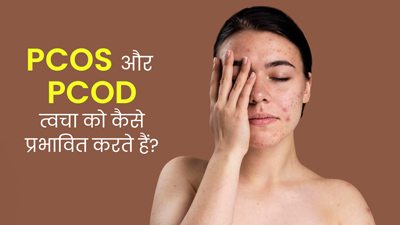 PCOS और PCOD में स्किन हेल्थ पर क्या असर पड़ता है? एक्सपर्ट से समझें