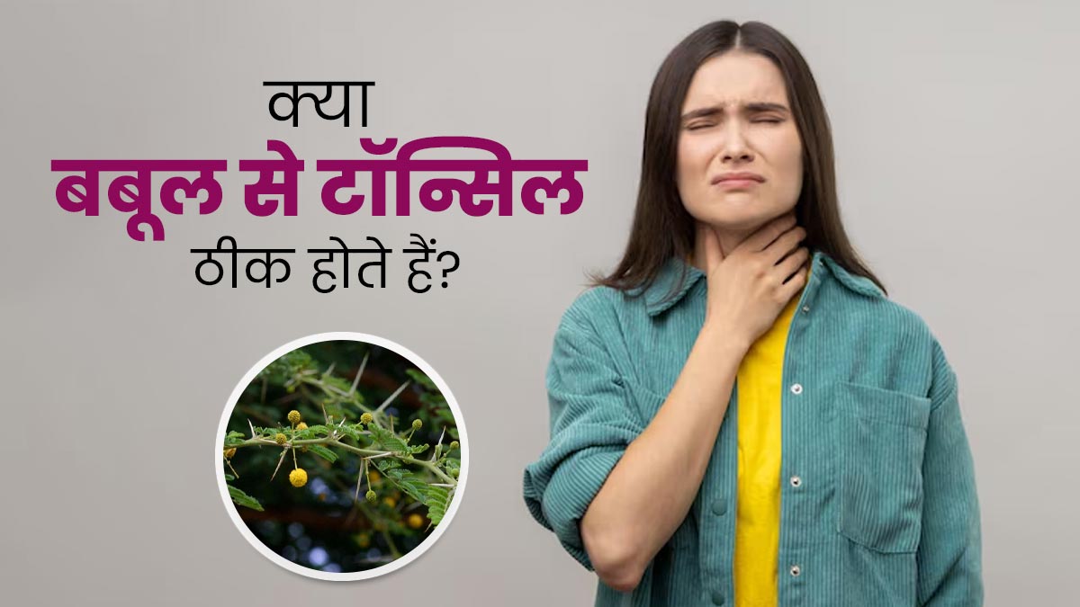 क्या बबूल से टॉन्सिल ठीक होते हैं? आयुर्वेदाचार्य से जानें