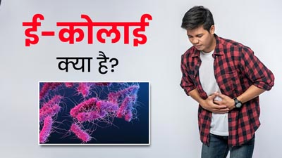 पेट में दर्द और ऐंठन ई.कोलाई संक्रमण के हो सकते हैं लक्षण, जानें इसका कारण और इलाज