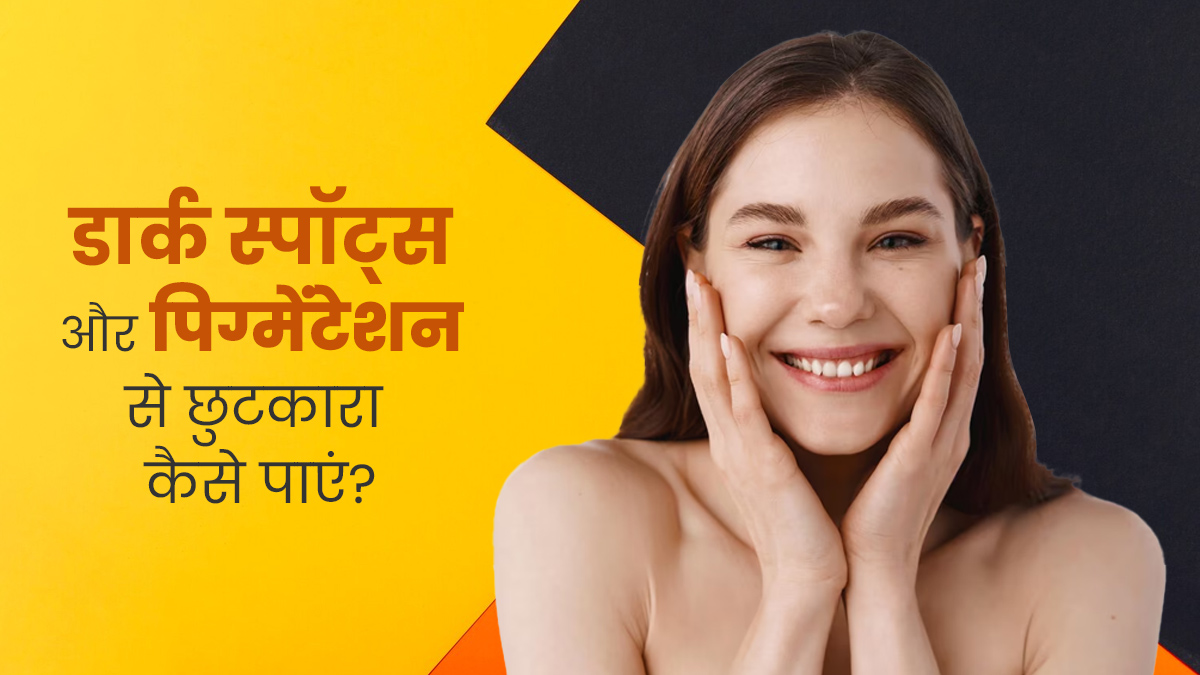 डार्क स्पॉट्स और पिग्मेंटेशन से छुटकारा पाने के लिए अपनाएं ये 5 तरीके, जानें इनके बारे में 