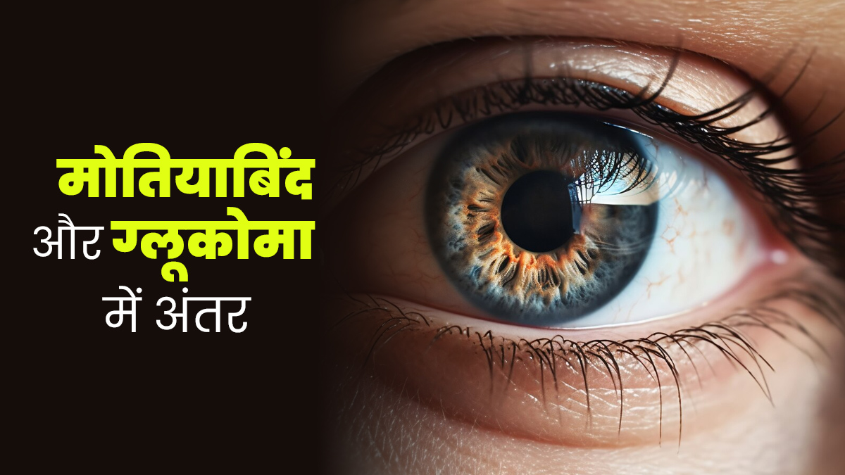 मोतियाबिंद और ग्लूकोमा में क्‍या अंतर होता है? एक्सपर्ट से जानें सही जानकारी