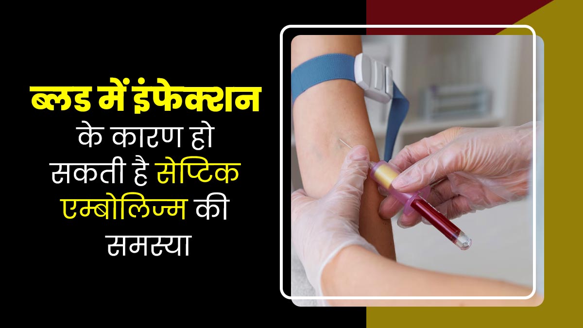 ब्लड में इंफेक्शन के कारण हो सकती है सेप्टिक एम्बोलिज्म की समस्या, डॉक्टर से जानें इसके लक्षण और इलाज 