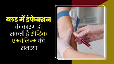 ब्लड में इंफेक्शन के कारण हो सकती है सेप्टिक एम्बोलिज्म की समस्या, डॉक्टर से जानें इसके लक्षण और इलाज 