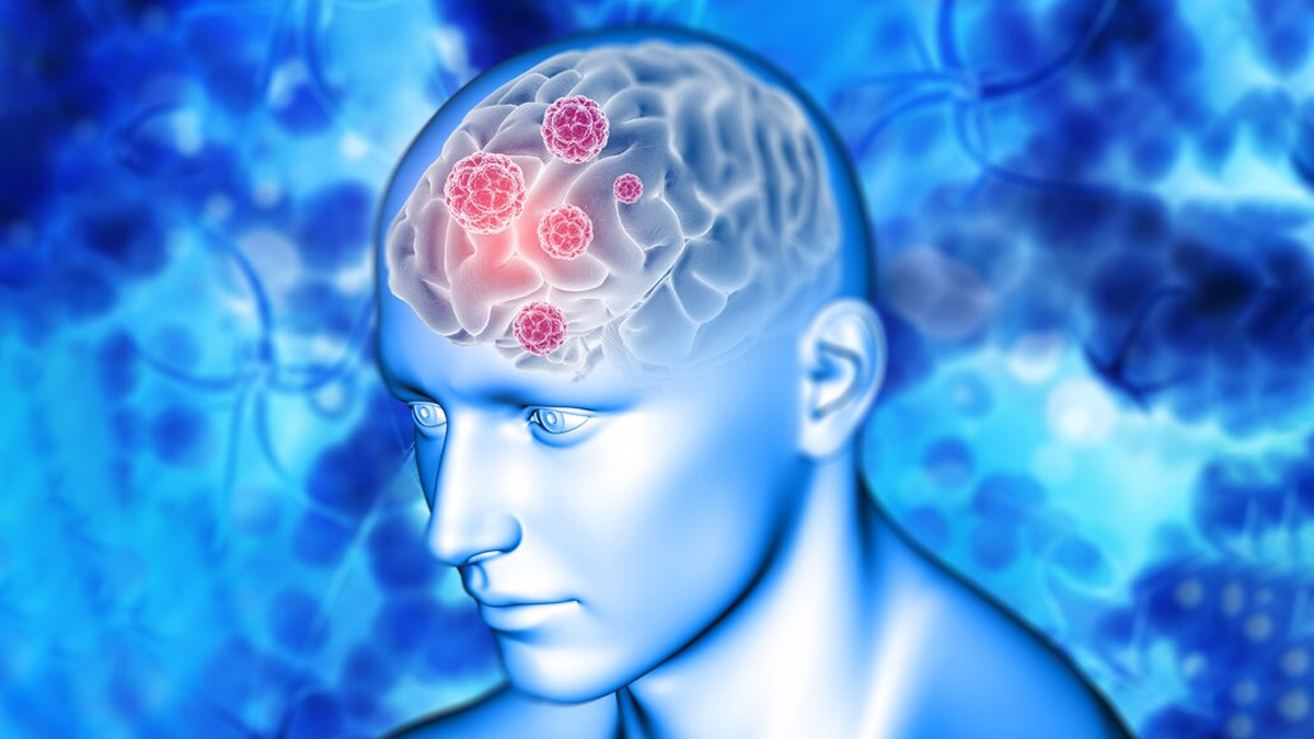 world-stroke-day-2024-ins2