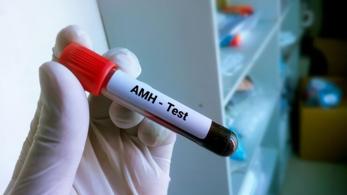 Simplifying AMH For You: Know What Is Your Fertility Score and More