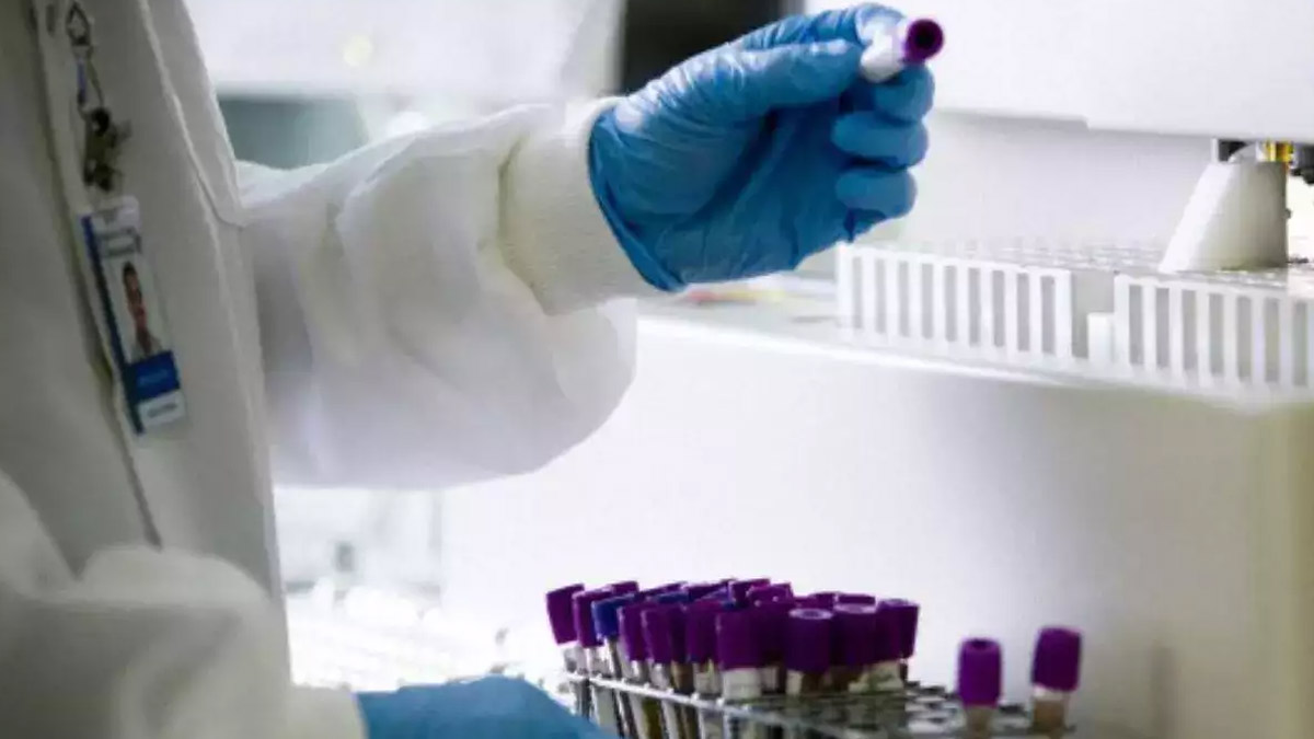 Breakthrough TB Research May Revolutionize Treatment of Inflammatory Disorders