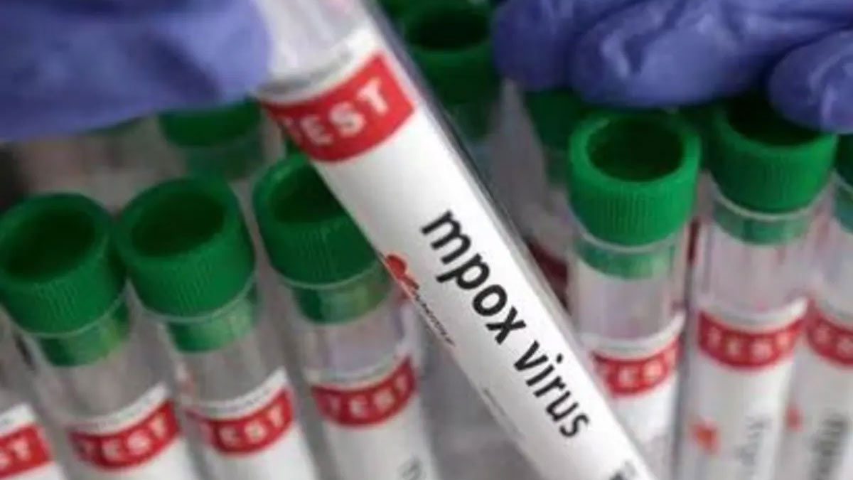 Pakistan's Peshawar Emerging As Epicentre Of Mpox Outbreak; UNICEF Steps Up With Aid