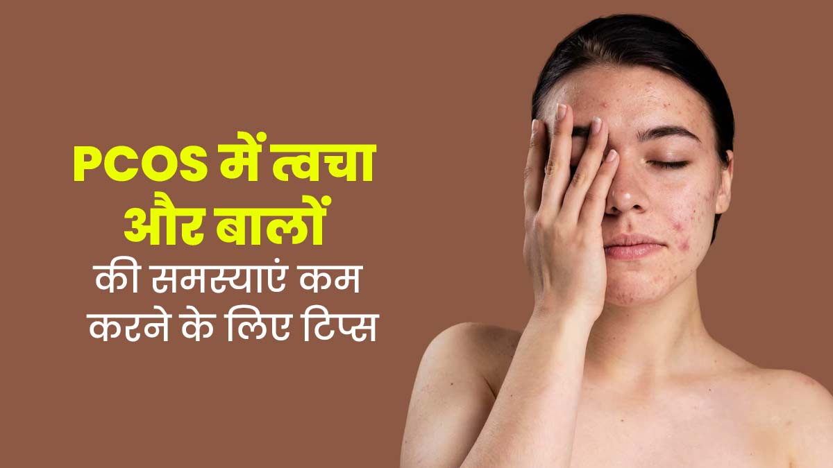 PCOS की वजह से बढ़ गई हैं त्वचा और बालों से जुड़ी समस्याएं, राहत के लिए अपनाएं ये 7 टिप्स