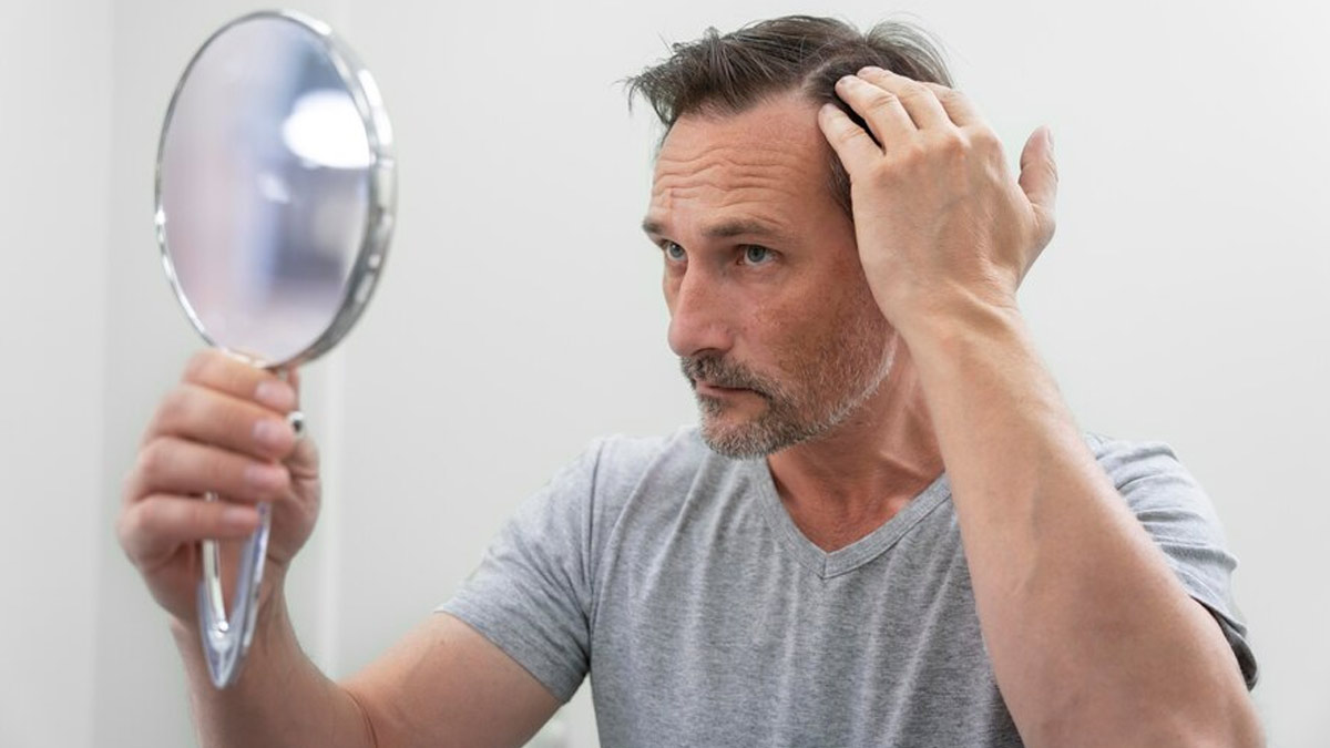 Stress And Alopecia: What Is The Link?