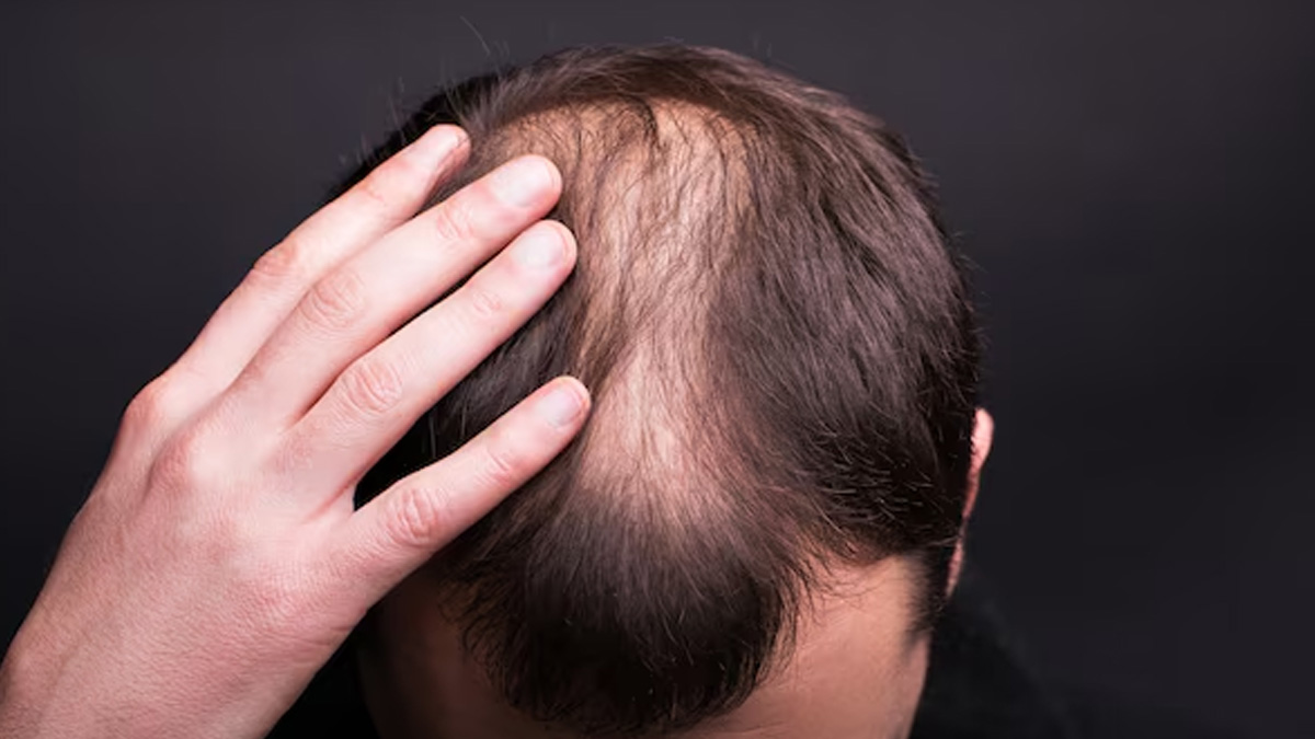 Beetroot and Yellow moong dal salad to control hair fall in Hindi