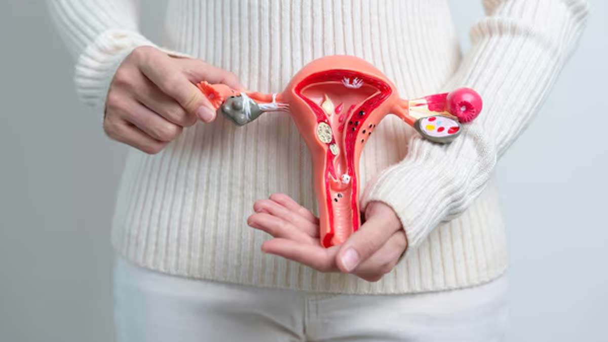 pcos