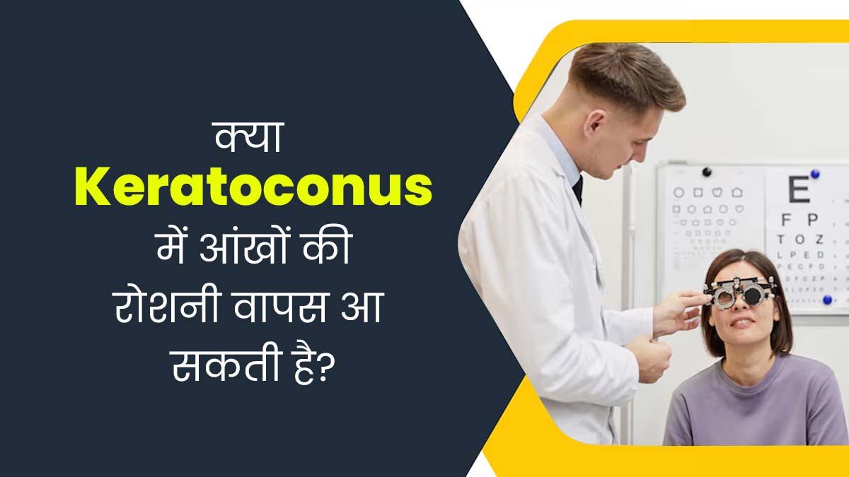 क्या Keratoconus के इलाज के बाद आंखों की रोशनी वापस आ सकती है? डॉक्टर से जानें