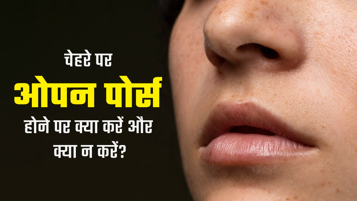 चेहरे पर हैं ओपन पोर्स, तो डर्मेटोलॉजिस्ट से जानें  क्या करें और क्या नहीं करें