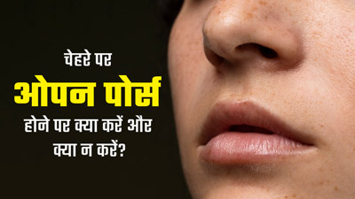 चेहरे पर हैं ओपन पोर्स, तो डर्मेटोलॉजिस्ट से जानें  क्या करें और क्या नहीं करें