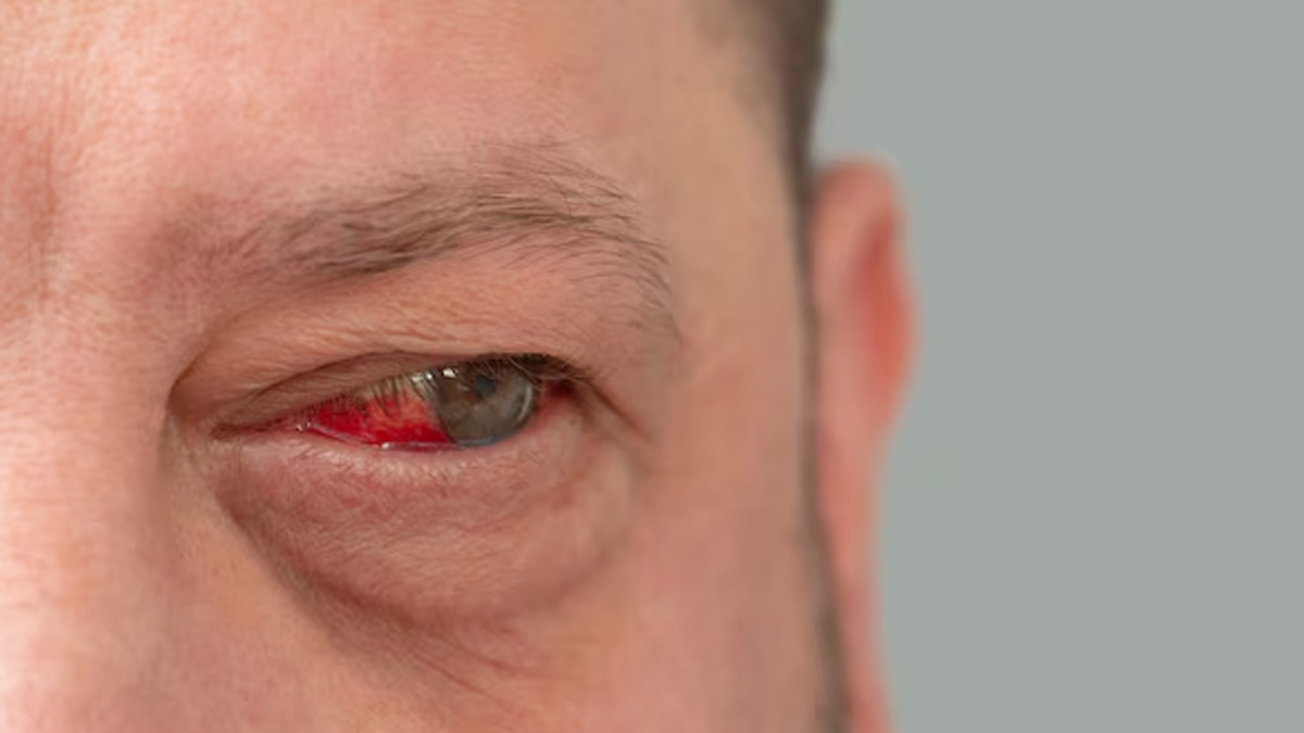 eye changes during cancer treatment 