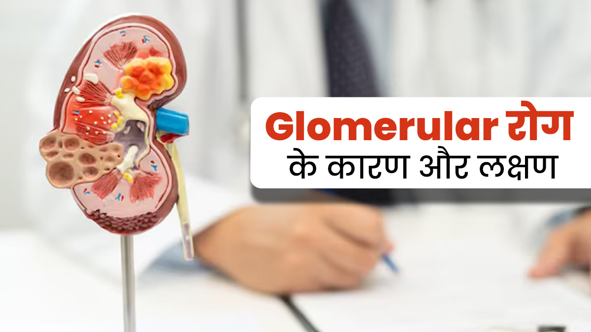 Glomerular रोग होने पर किडनी खून को नहीं कर पाती है फिल्टर, जानें इसके कारण और लक्षण  