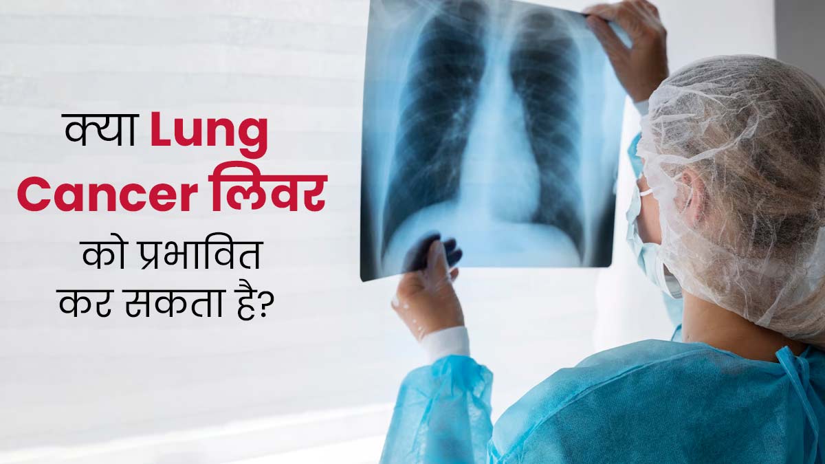 क्या फेफड़ों के कैंसर से लिवर प्रभावित होता है? एक्सपर्ट से जानें दोनों में संबंध
