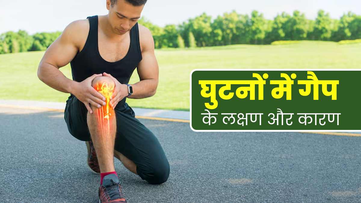 चलने में परेशानी की वजह बन सकता है घुटनों का गैप, जानें इसके कारण और लक्षण 
