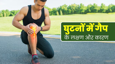 चलने में परेशानी की वजह बन सकता है घुटनों का गैप, जानें इसके कारण और लक्षण 