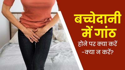 बच्चेदानी में गांठ होने पर क्या करें और क्या नहीं? जानें डॉक्टर से