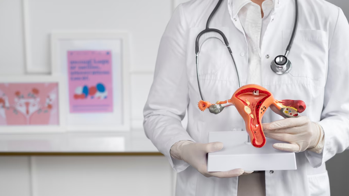 Things To Do And Avoid If You Have Cyst In Uterus 