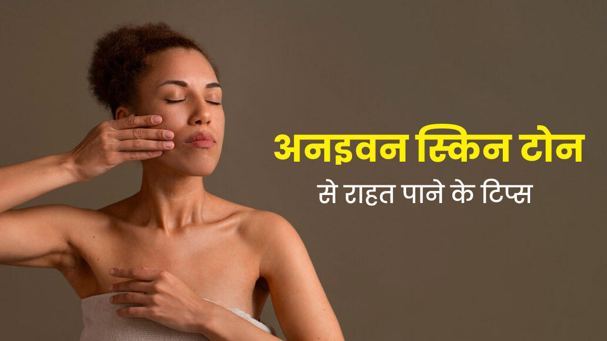 चेहरे की असमान रंगत (Uneven Skin Tone) सुधारने के लिए अपनाएं ये 5 टिप्स